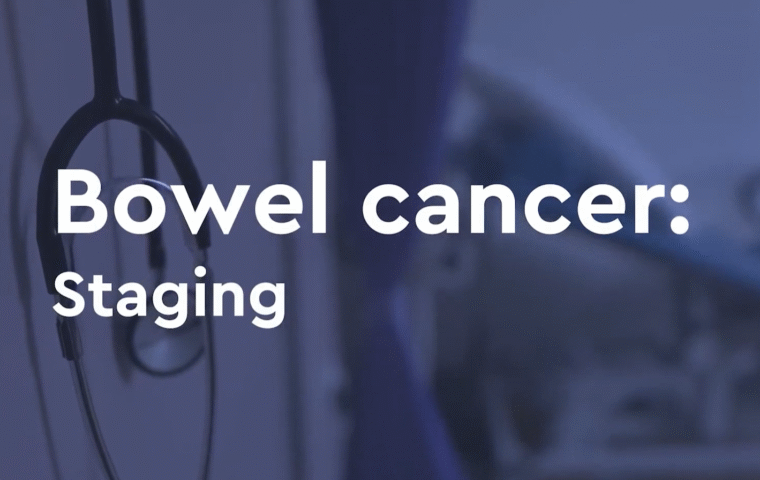 Thumbnail for How bowel cancer is staged